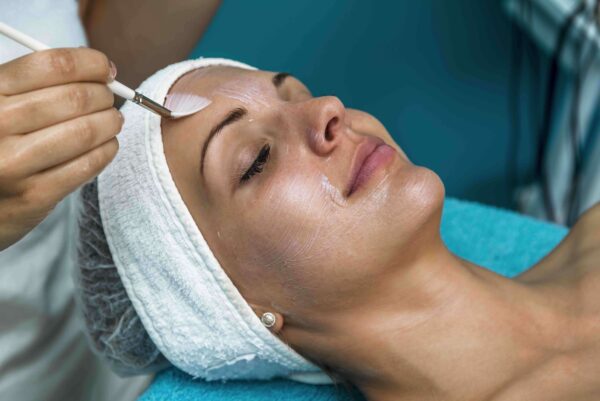 The Most Common Chemical Peels